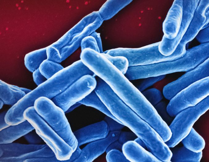 Mycobacterium Tuberculosis Bacteria Scanning electron micrograph of Mycobacterium tuberculosis particles (colorized blue), the bacterium which causes TB. 